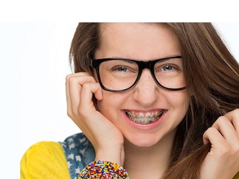 Braces
