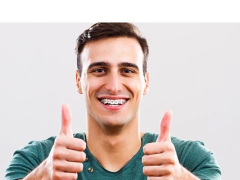Invisalign